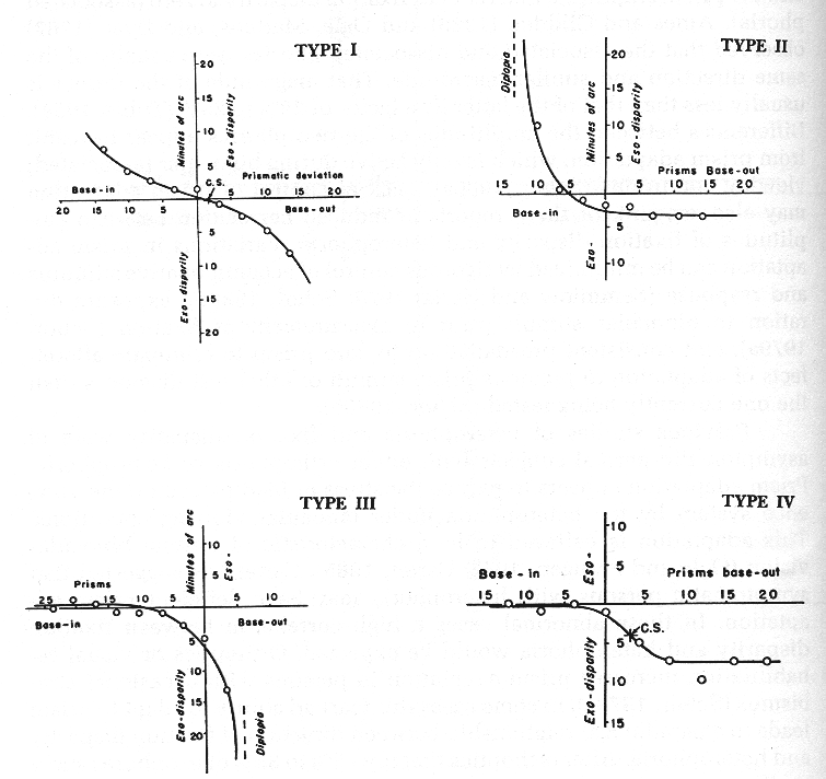 bva_fixationdisparity.htm